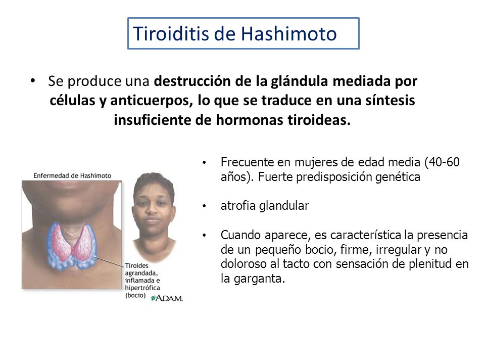 La dieta curativa para la tiroiditis de hashimoto pdf